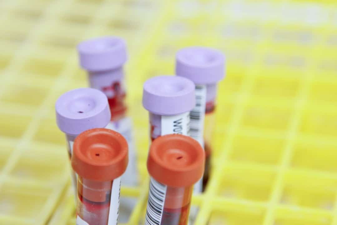 Bloedbuisjes voor een longevity bloedtest met biomarkers